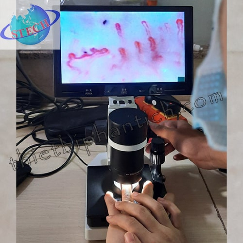Kính hiển vi soi mạch máu SM-400X-10D (kèm màn hình 10 inch)